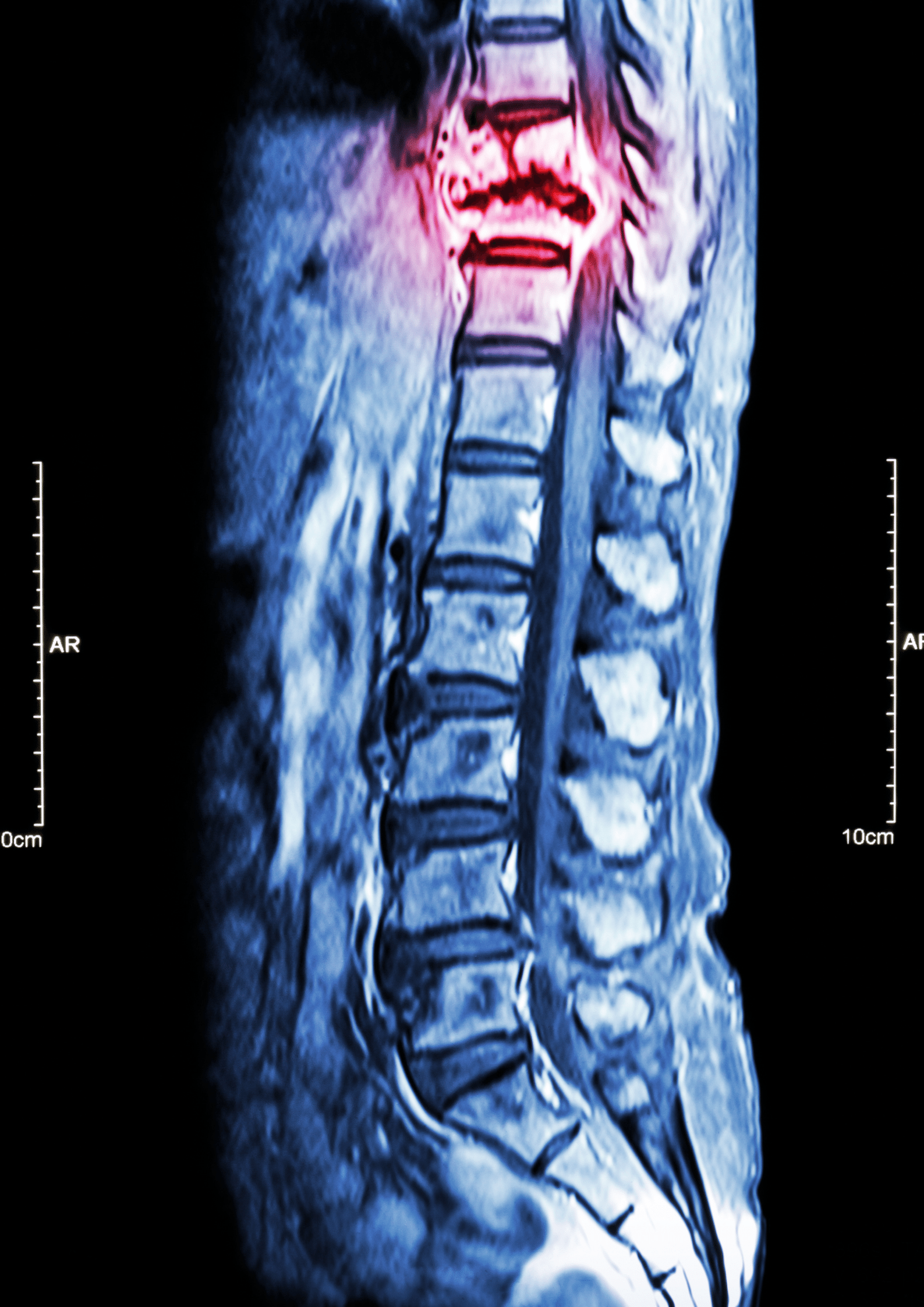 Orthopedic & Spine